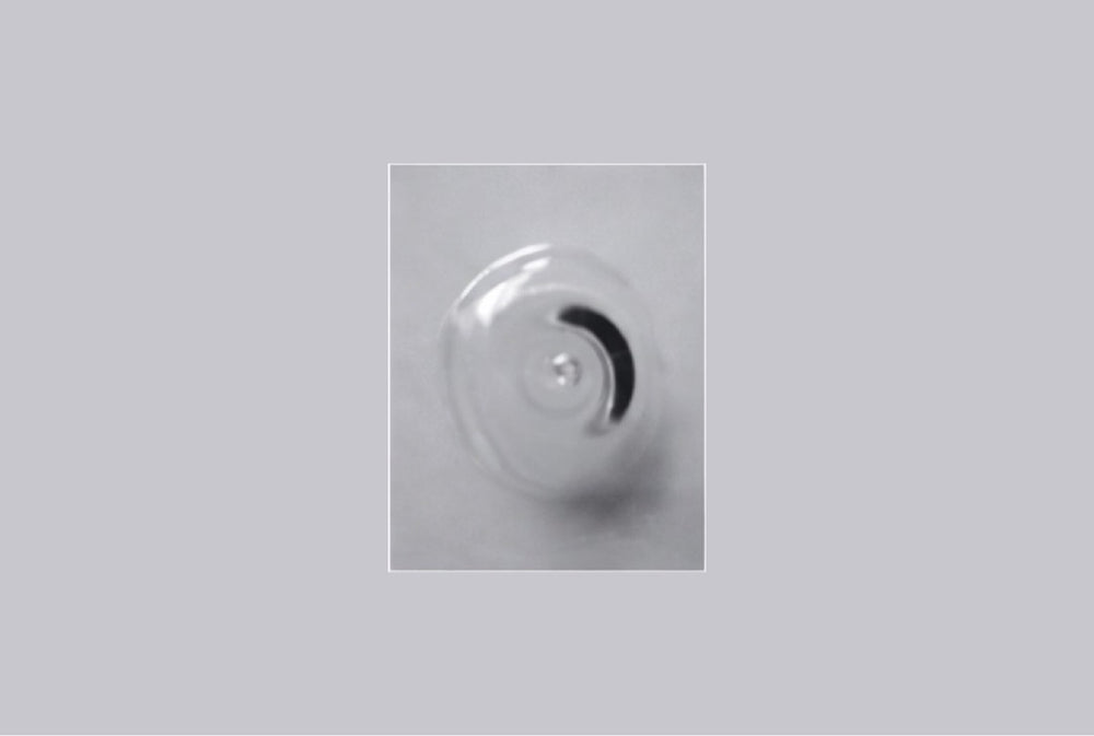 Smaller Than a Nickel? Chips that size, including crack lines, can usually be repaired.